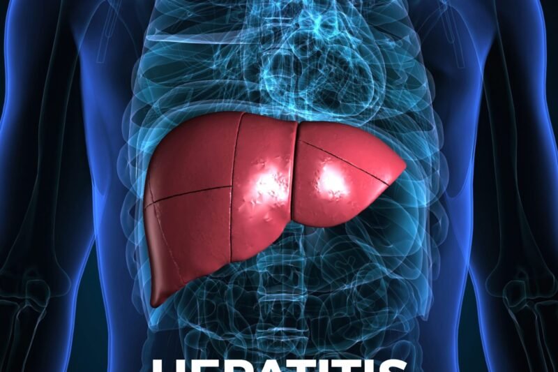 Hepatitis: Perkembangan Terkini dan Pemahaman Mendalam