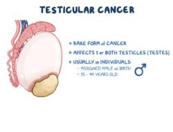 Kanker Testis: Mengenal, Memahami, dan Melawan Ancamannya
